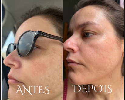 Antes e depois