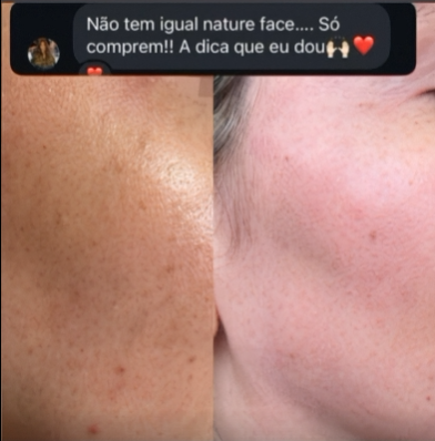 Antes e depois NatureFace